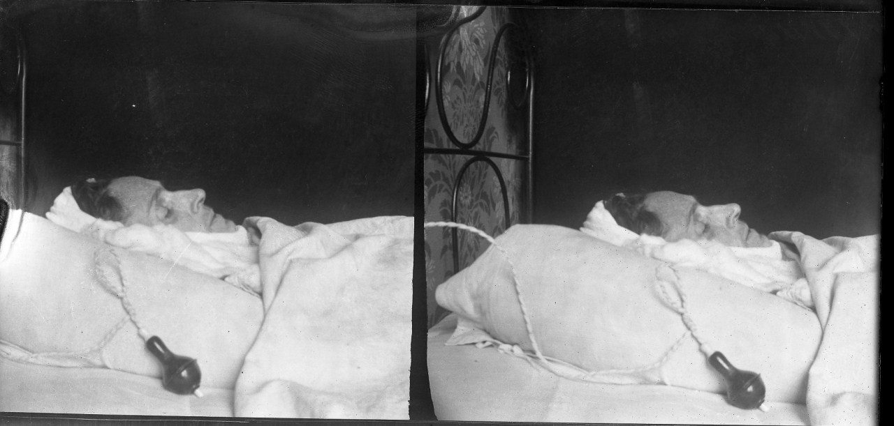 Margherita Papini sul letto di morte; ripresa ravvicinata (negativo) di Vermehren, Otto (inizio XX)