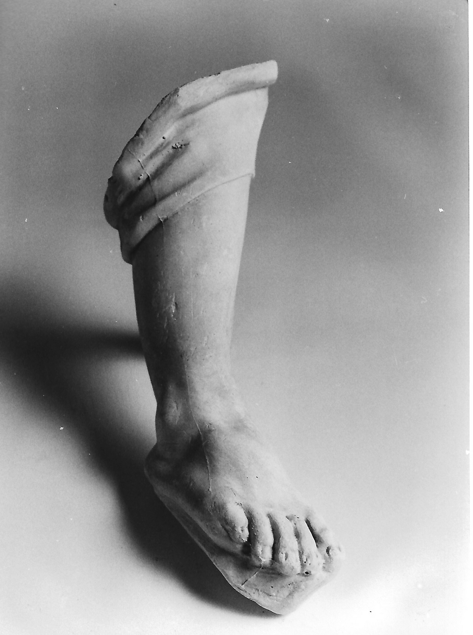 gamba destra di bambino (calco, serie) - produzione coreglina (fine sec. XIX)