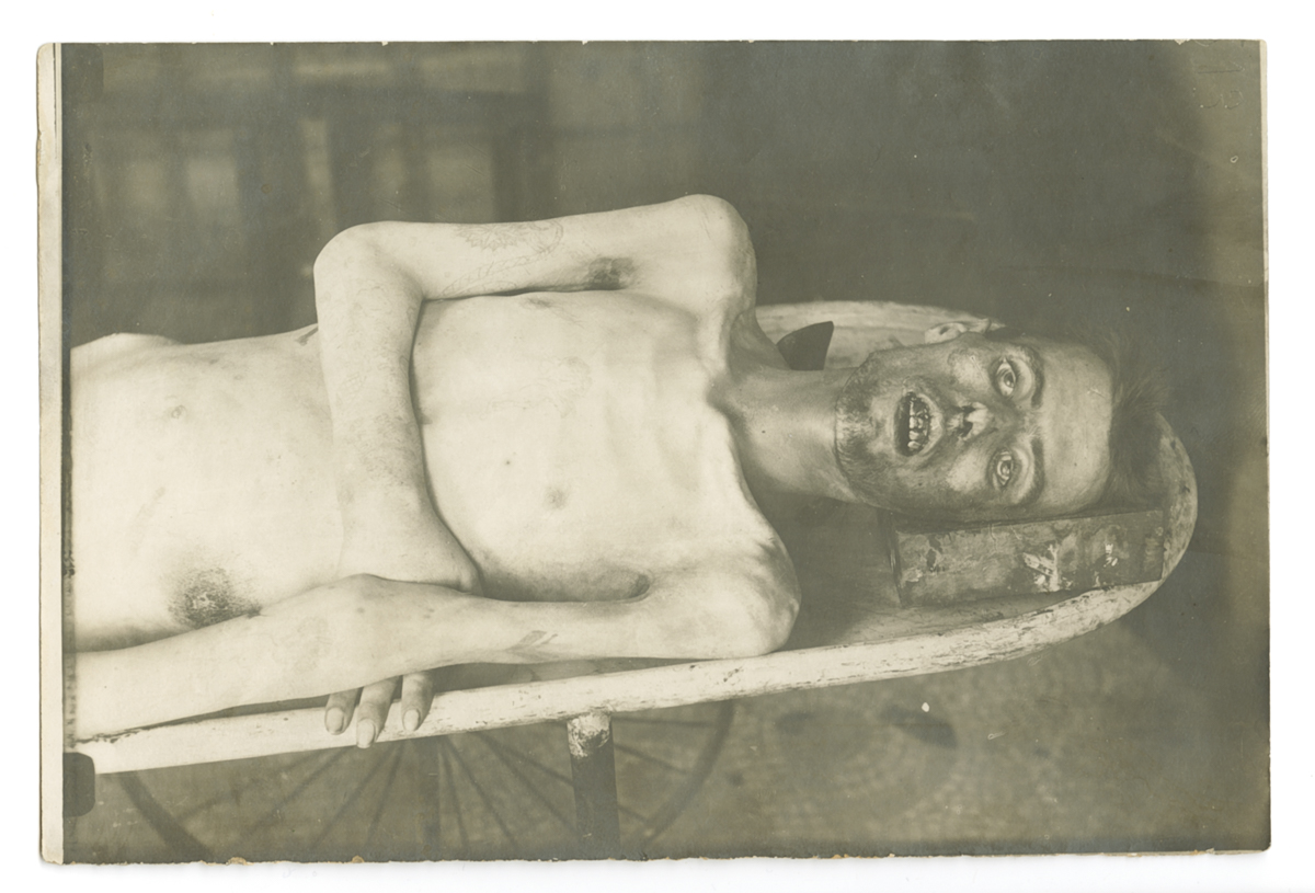 Iconografia, Morte - Cadaveri (positivo) di Autore non identificato, Carrara, Mario - fotografia medica (fine/ metà XIX-XX)