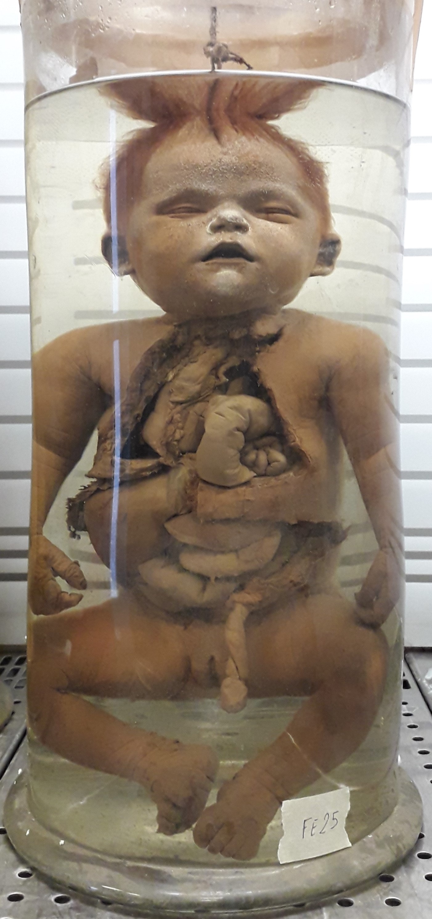 preparato anatomico, feto (morfologia naturale) (prima metà SECOLI/ XIX)