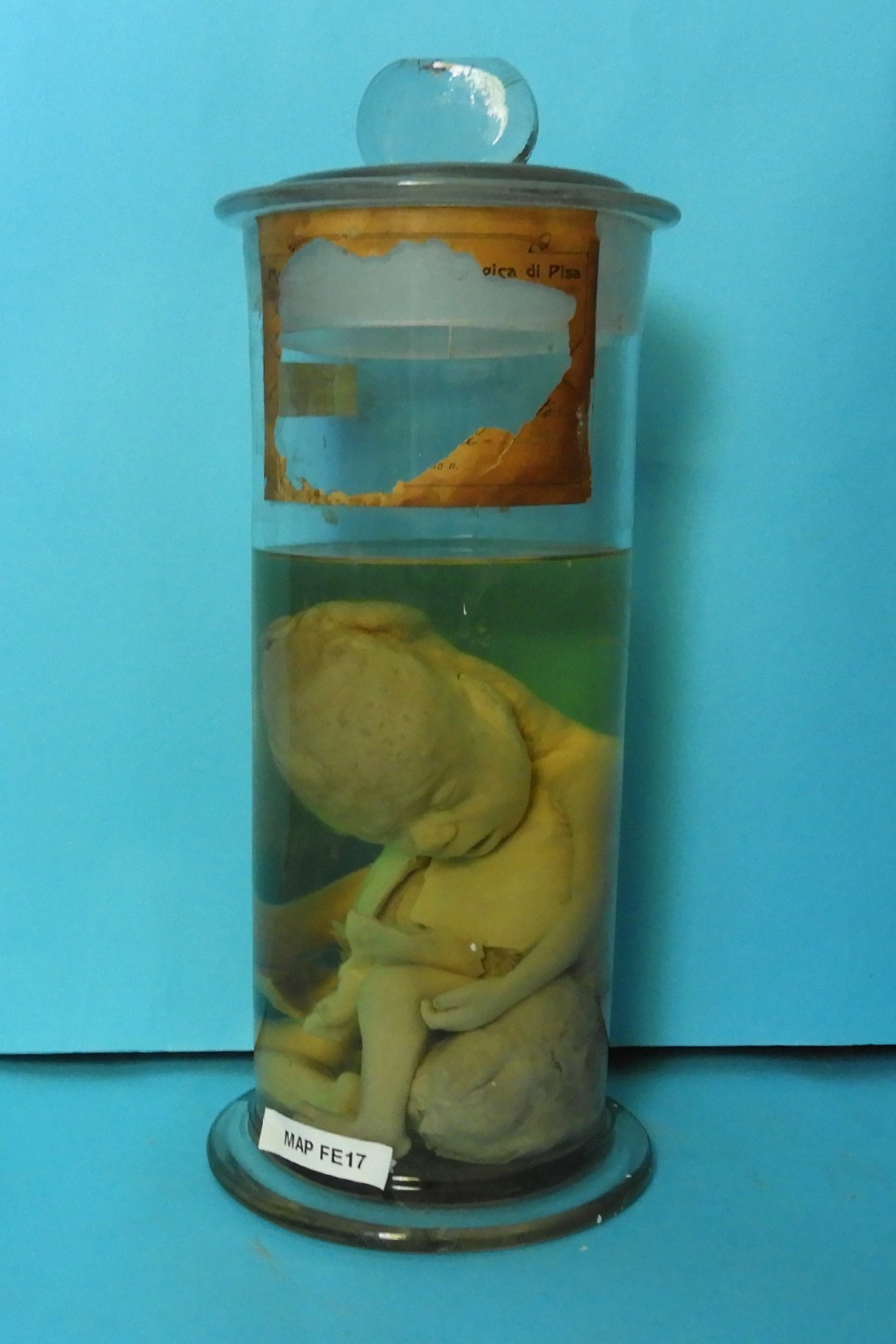preparato anatomico, feto (morfologia naturale) (prima metà SECOLI/ XIX)
