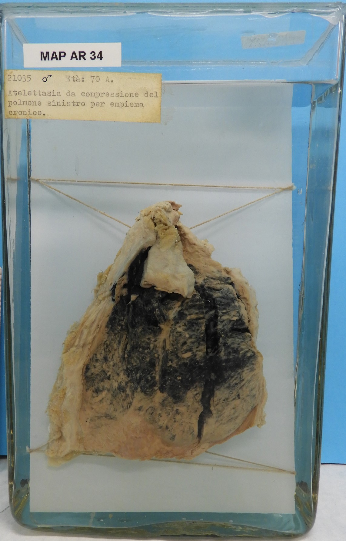 preparato anatomico, apparato respiratorio (morfologia naturale) (SECOLI/ XX)