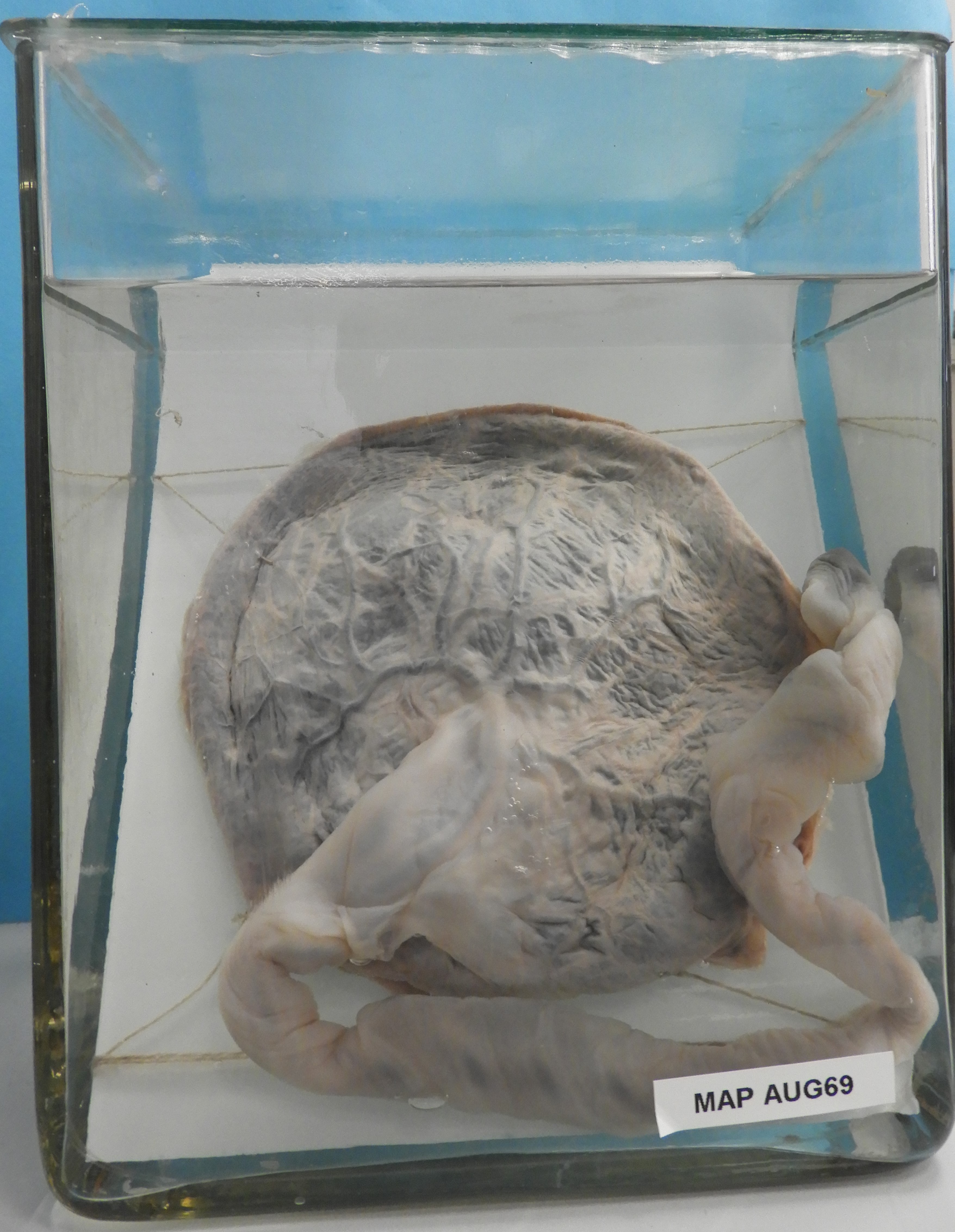 preparato anatomico, apparato urogenitale (morfologia naturale) (SECOLI/ XX)