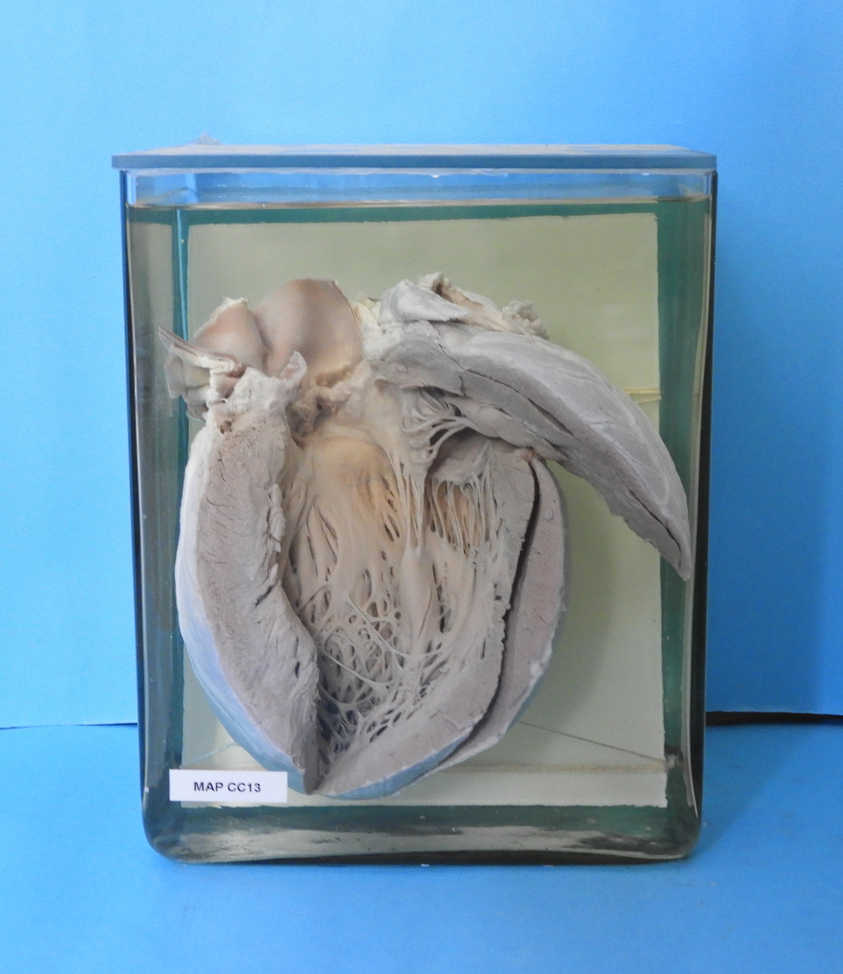 preparato anatomico, apparato cardiocircolatorio (morfologia naturale) (SECOLI/ XX)