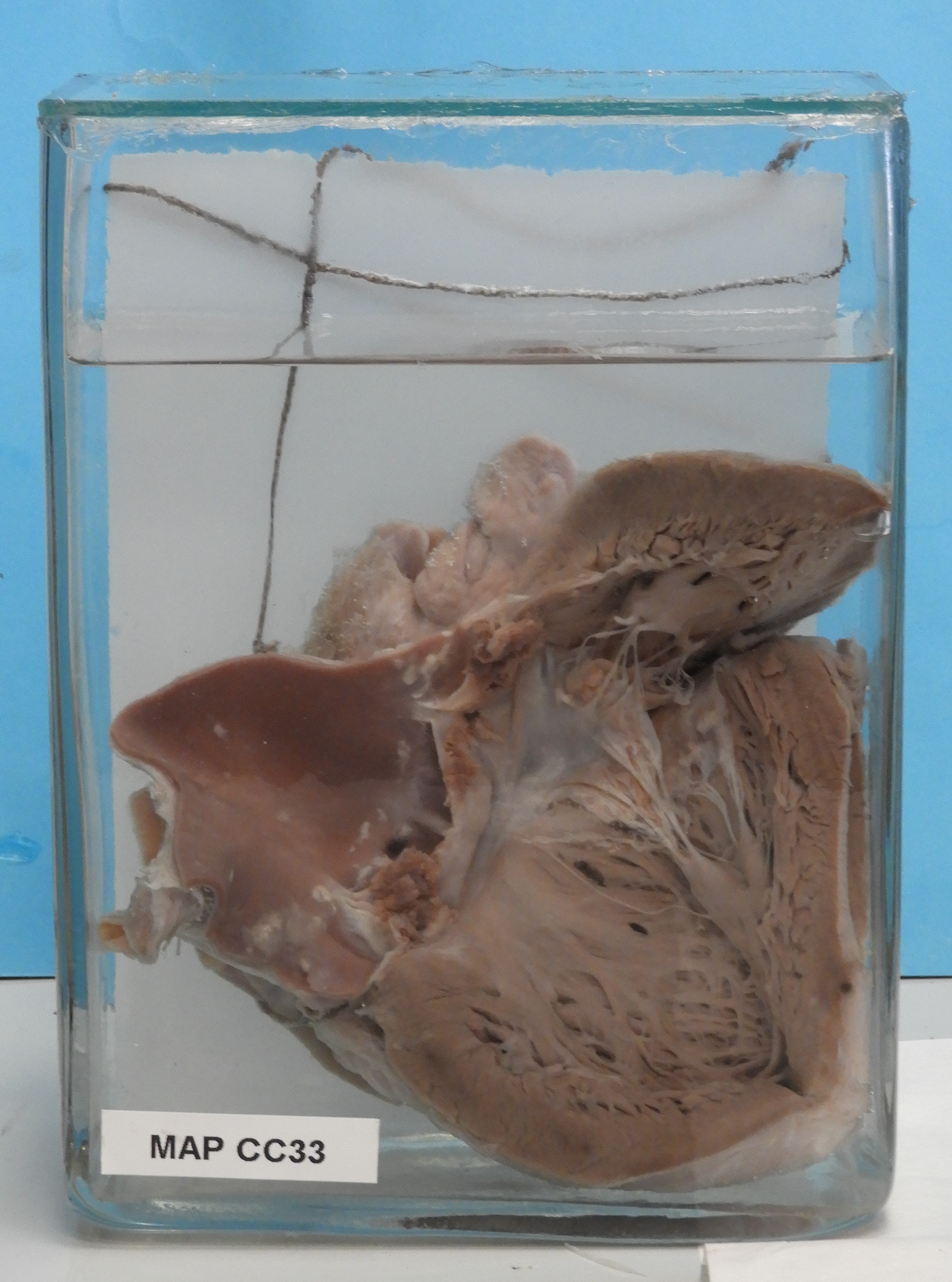 preparato anatomico, apparato cardiocircolatorio (morfologia naturale) (SECOLI/ XX)