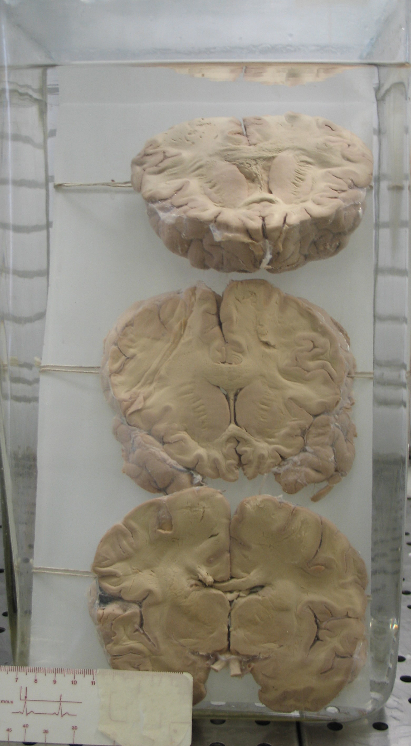 preparato anatomico, sistema nervoso (morfologia naturale) (SECOLI/ XX)