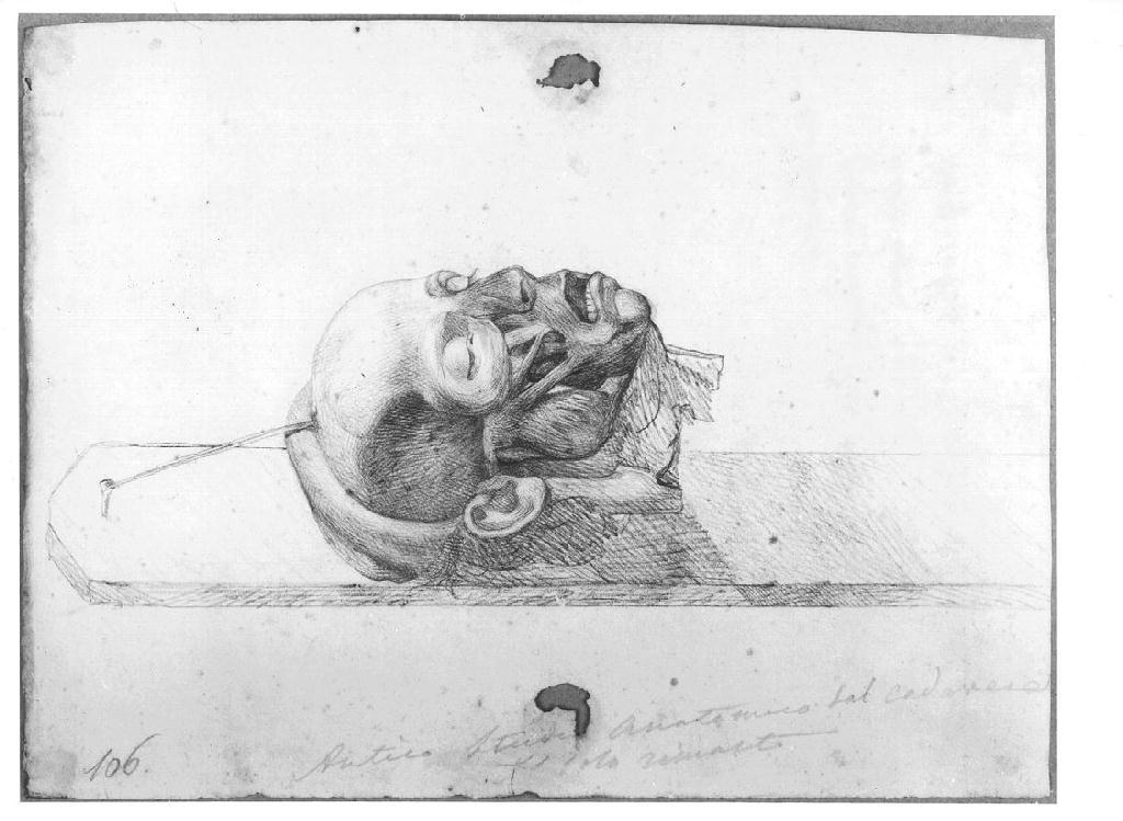 Studio anatomico di testa, testa di uomo (disegno, opera isolata) di Levi Gioacchino (metà sec. XIX)