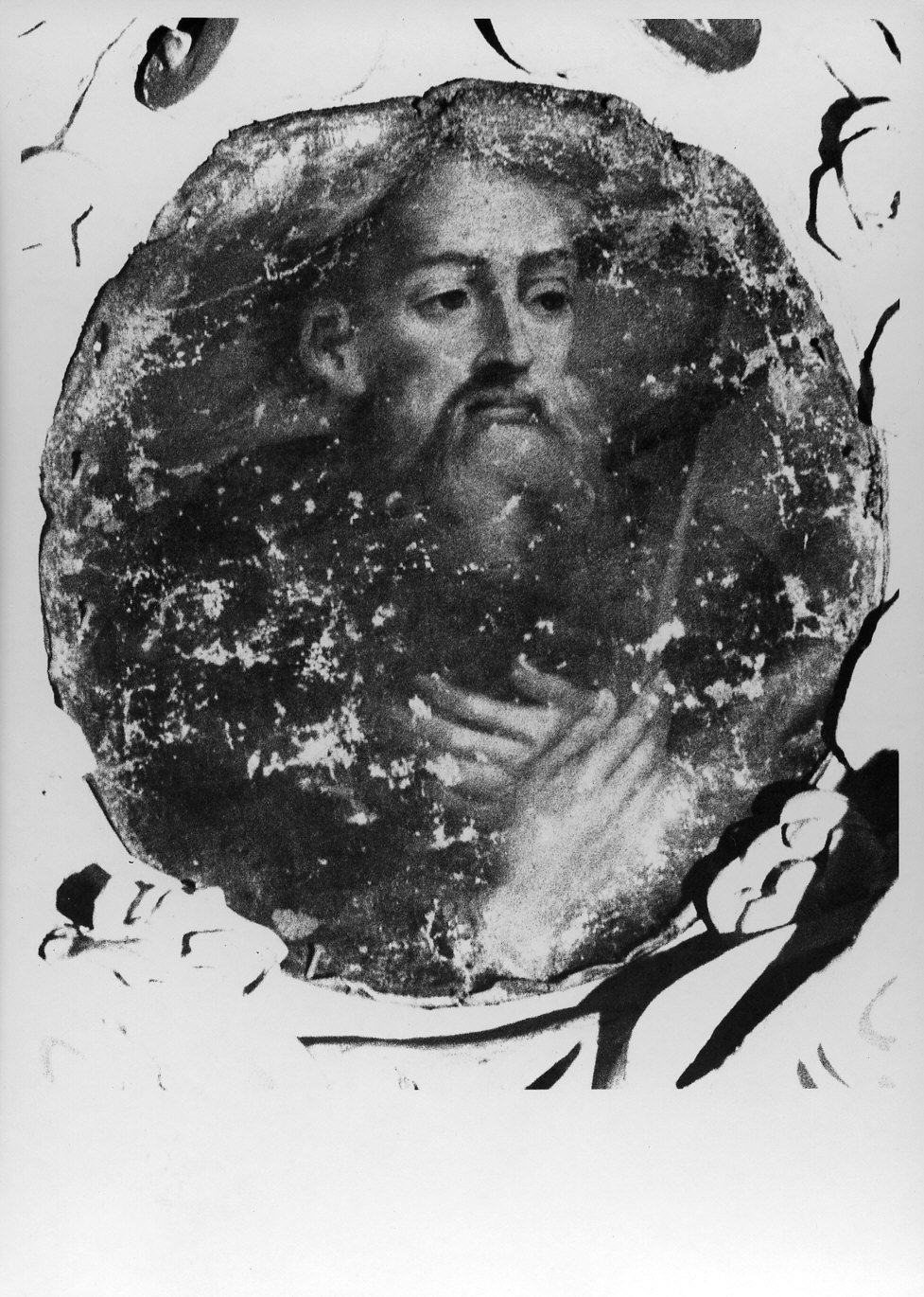beato Pellegrino Laziosi (dipinto, opera isolata) - ambito lombardo (prima metà sec. XVIII)