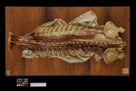 cera anatomica, Muscoli dorsali di Susini Clemene (inizio sec. XIX)