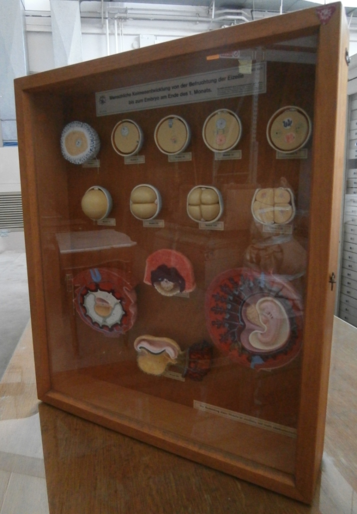 modello anatomico, MS 15/1 sviluppo dell'embrione umano fino al terzo mese (metà XX sec)