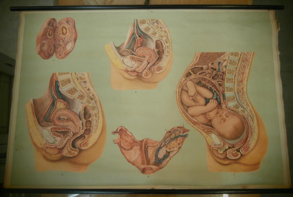 tavola parietale, utero (seconda metà XX sec)