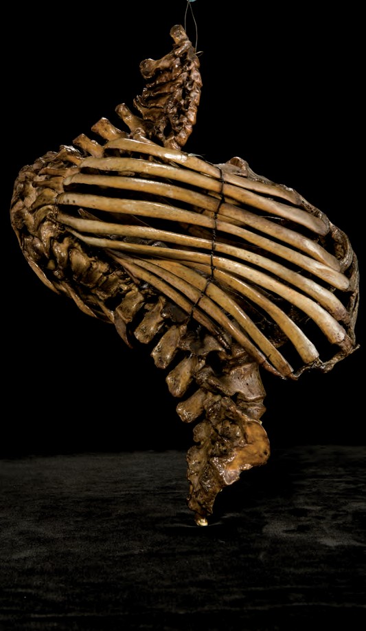 singolo reperto antropologico, reperto osseo (morfologia alterata per patologia) (XIX-XX)