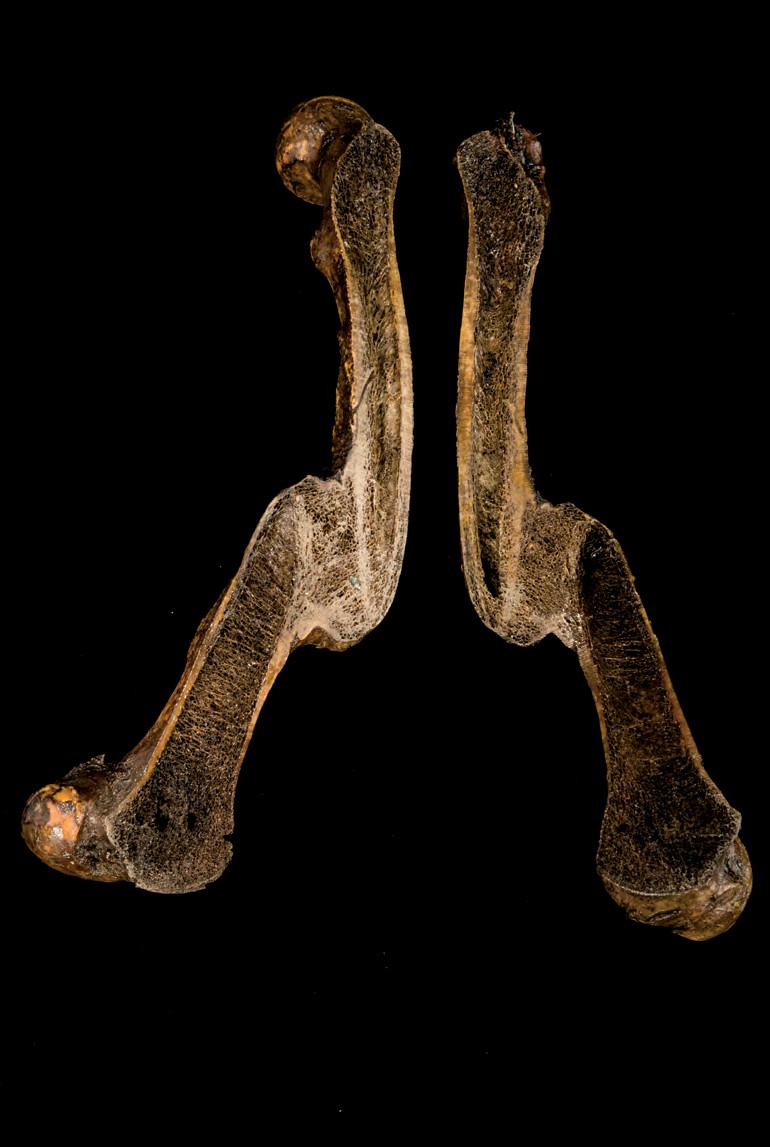 singolo reperto antropologico, reperto osseo (morfologia alterata per patologia) (XIX-XX)