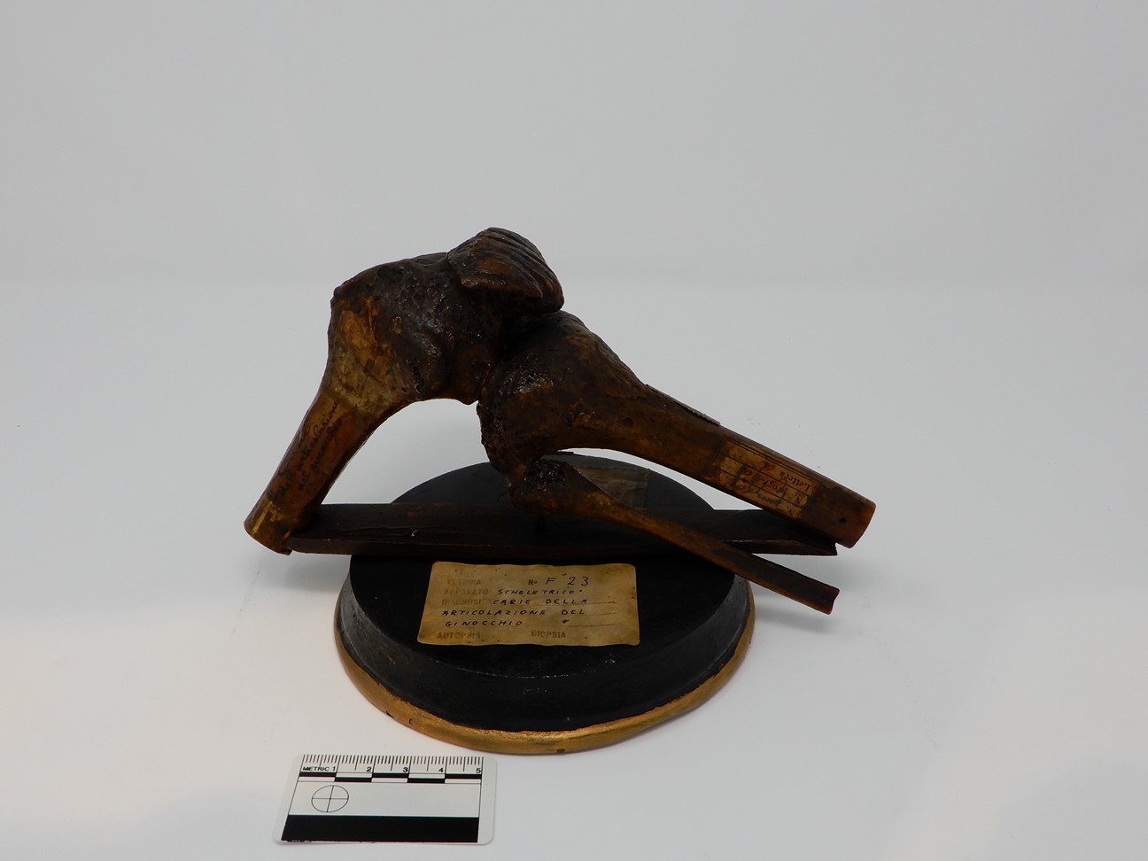 singolo reperto antropologico, reperto osseo (morfologia alterata per patologia) (XIX-XX)