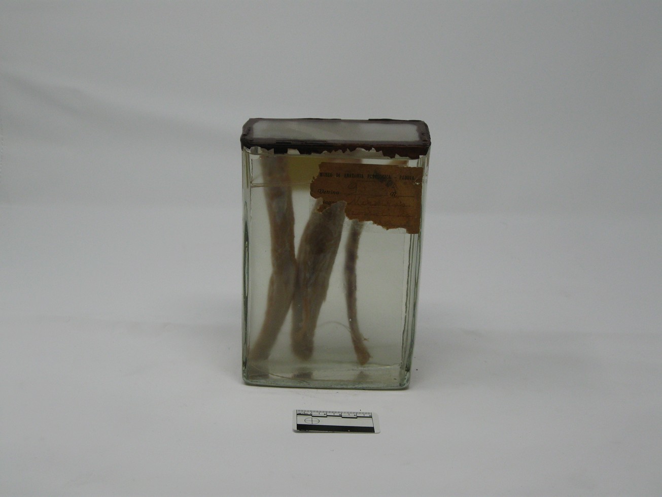 singolo reperto antropologico, reperto osseo (morfologia alterata per patologia) (XIX-XX)