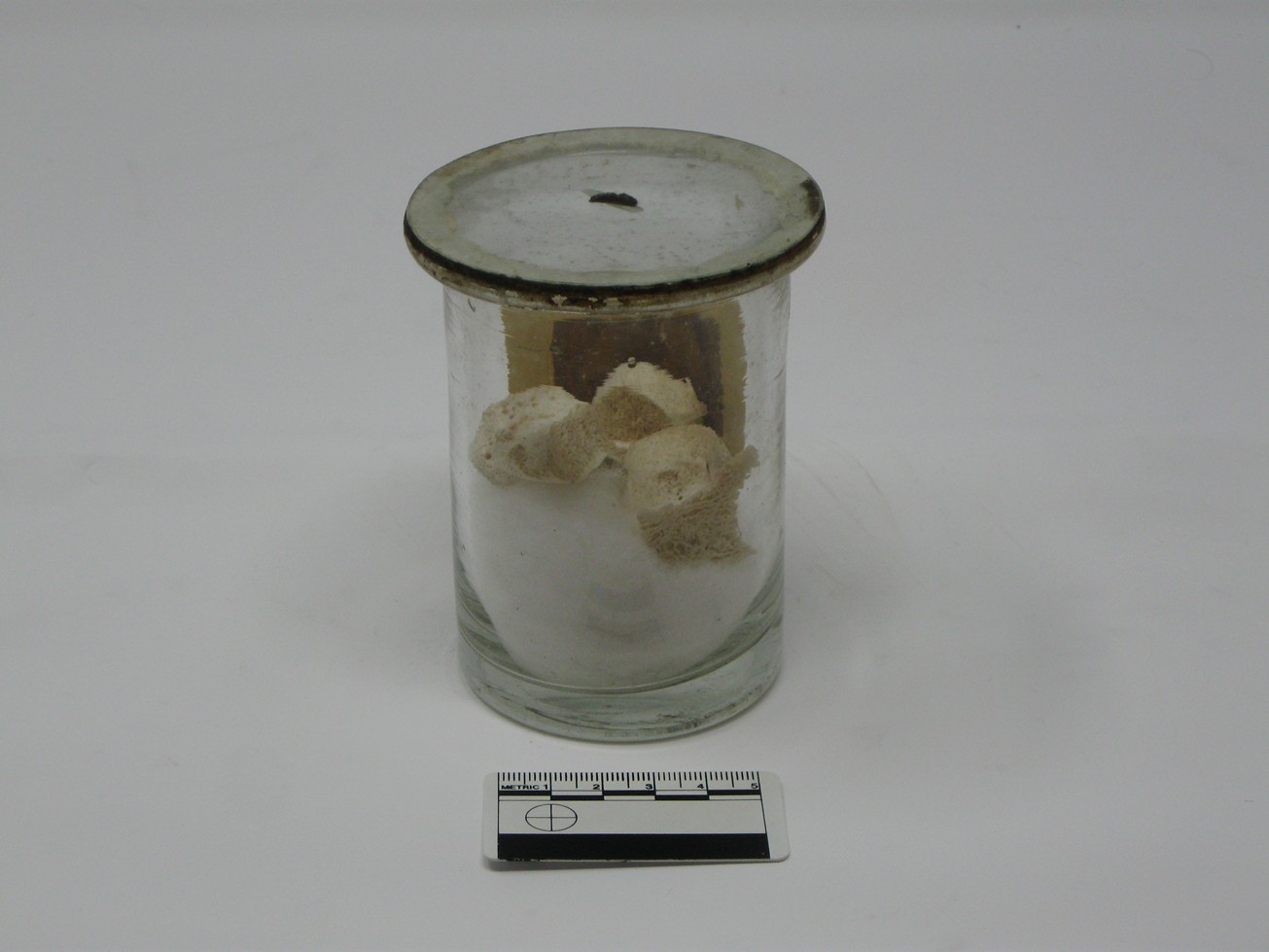 singolo reperto antropologico, reperto osseo (morfologia alterata per patologia) (XIX-XX)