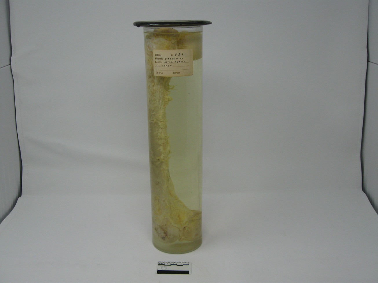 singolo reperto antropologico, reperto osseo (morfologia alterata per patologia) (XIX-XX)