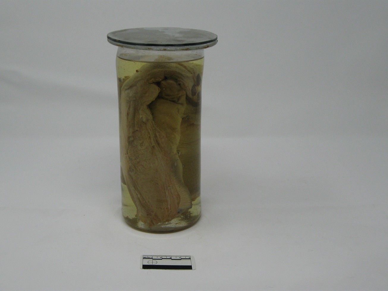 singolo reperto antropologico, reperto osseo (morfologia alterata per patologia) (XIX-XX)