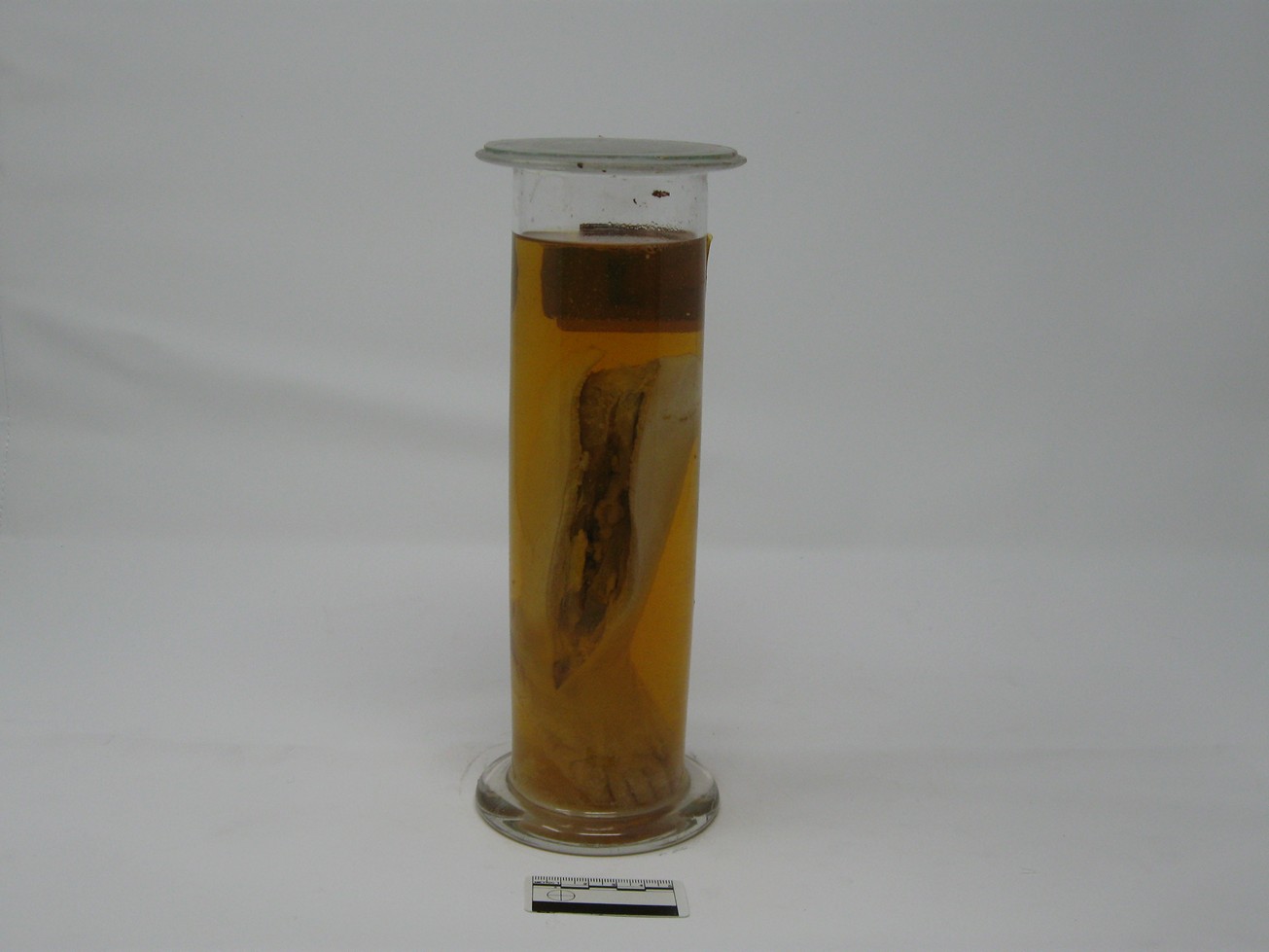 singolo reperto antropologico, reperto osseo (morfologia alterata per patologia) (XIX-XX)