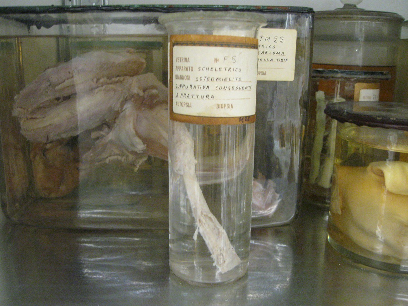 singolo reperto antropologico, reperto osseo (morfologia alterata per patologia) (XIX-XX)