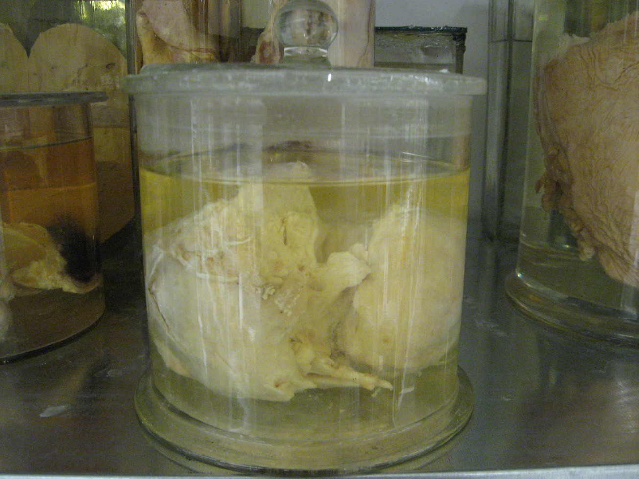 singolo reperto antropologico, reperto osseo (morfologia alterata per patologia) (XIX-XX)