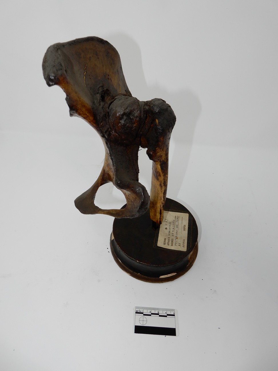 singolo reperto antropologico, reperto osseo (morfologia alterata per patologia) (XIX-XX)