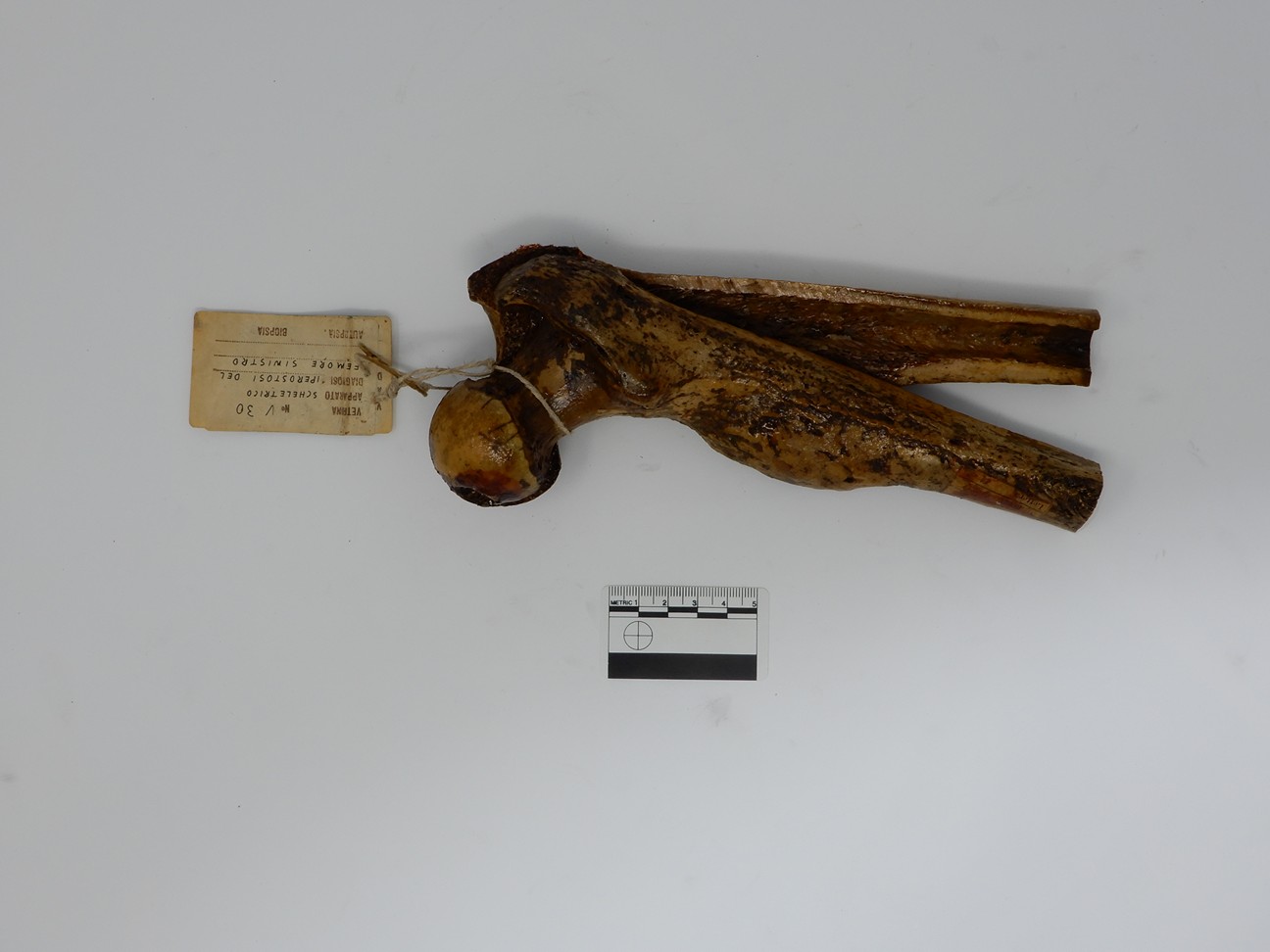 singolo reperto antropologico, reperto osseo (morfologia alterata per patologia) (XIX-XX)