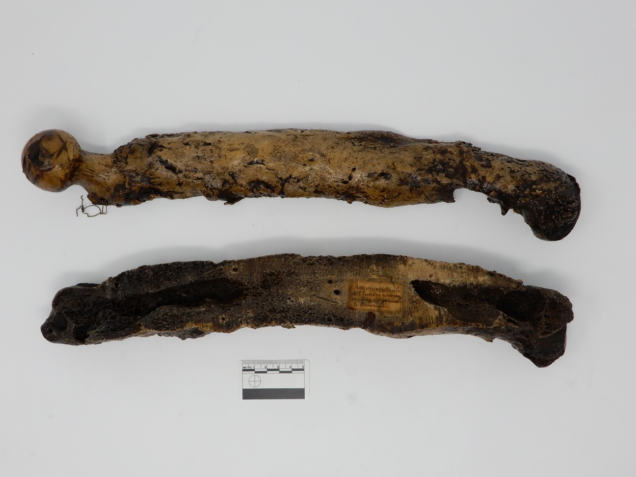 singolo reperto antropologico, reperto osseo (morfologia alterata per patologia) (XIX-XX)