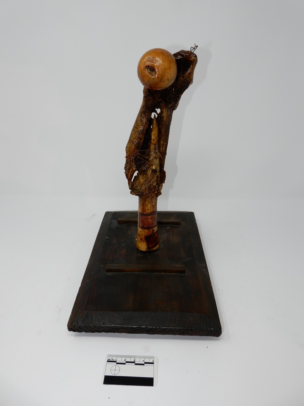 singolo reperto antropologico, reperto osseo (morfologia alterata per patologia) (XIX-XX)