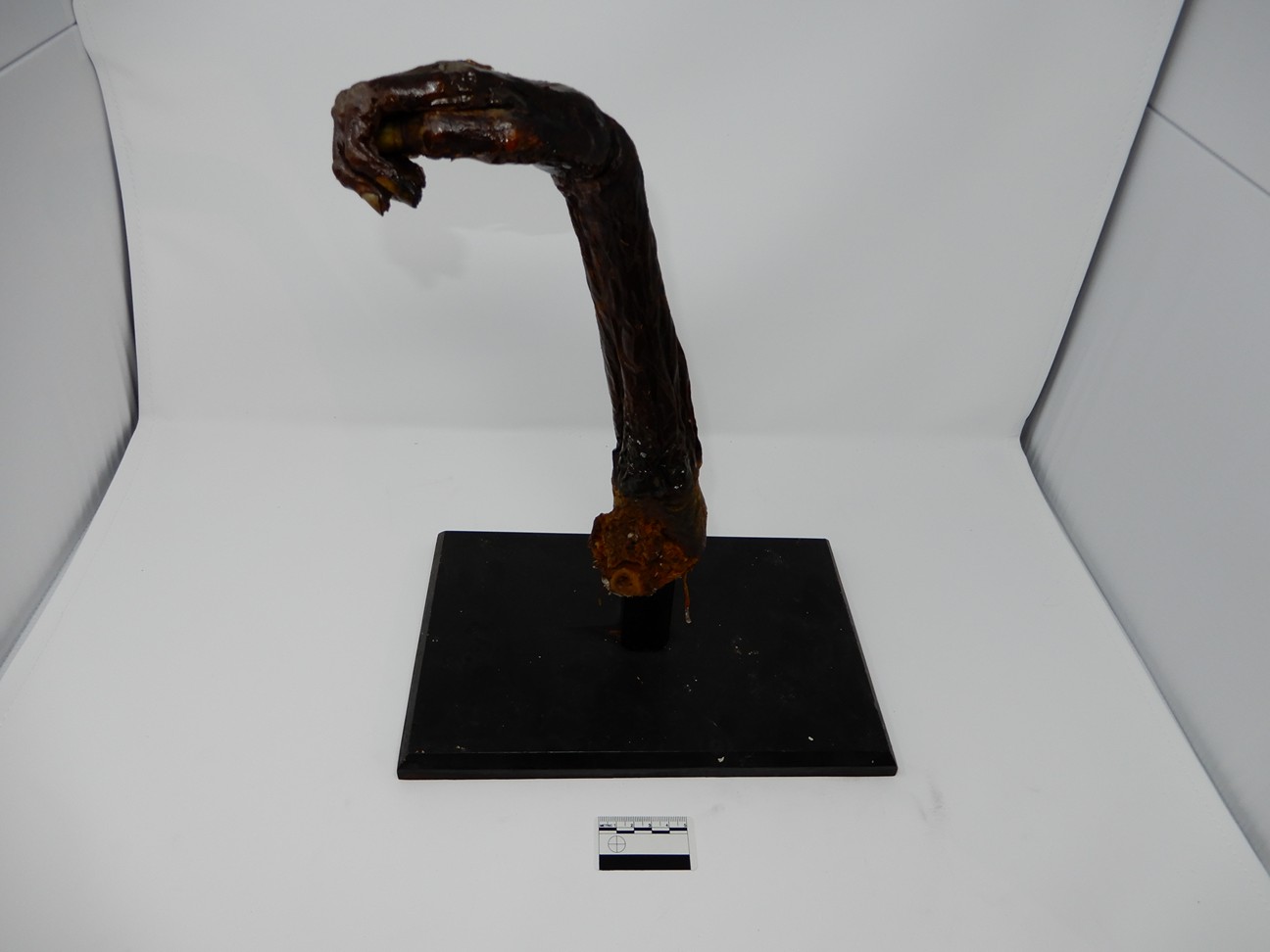 singolo reperto antropologico, reperto osseo (morfologia alterata per patologia) (XIX-XX)