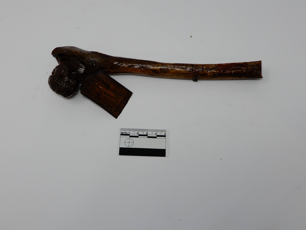 singolo reperto antropologico, reperto osseo (morfologia alterata per patologia) (XIX-XX)