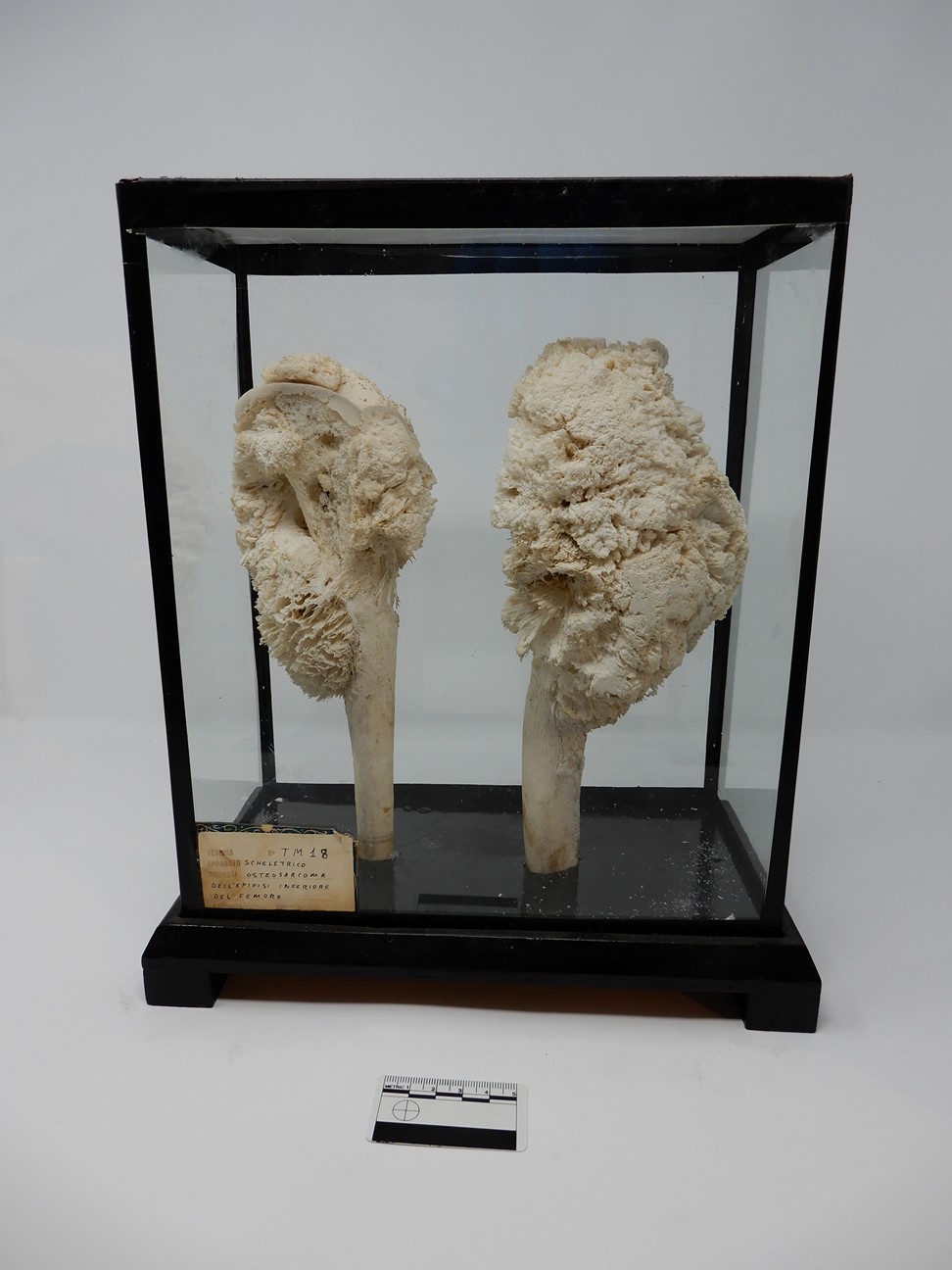 singolo reperto antropologico, reperto osseo (morfologia alterata per patologia) (XIX-XX)