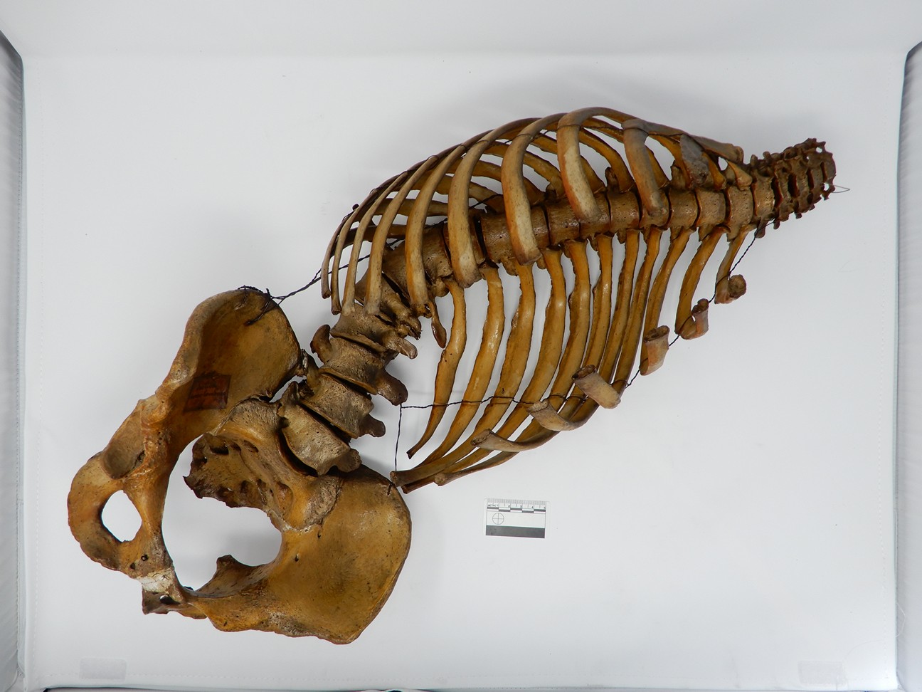 singolo reperto antropologico, reperto osseo (morfologia alterata per patologia) (XIX-XX)