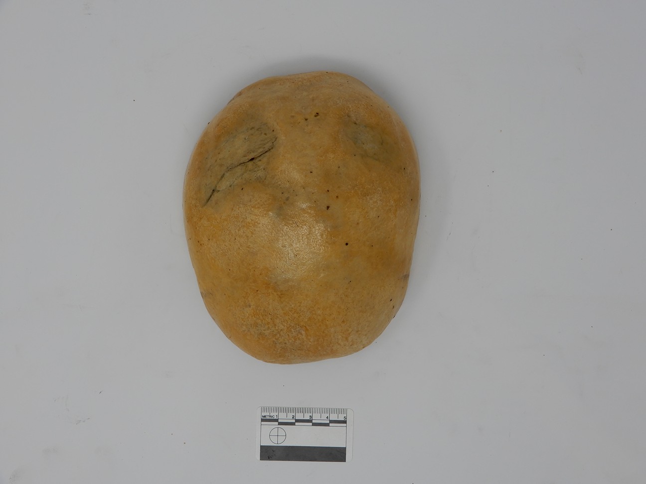 singolo reperto antropologico, reperto osseo (morfologia alterata per patologia) (XIX-XX)