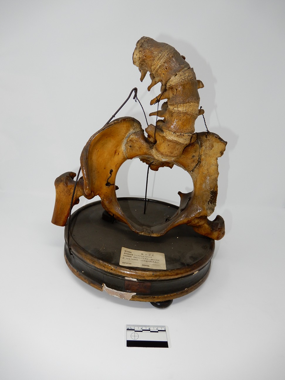 singolo reperto antropologico, reperto osseo (morfologia alterata per patologia) (XIX-XX)