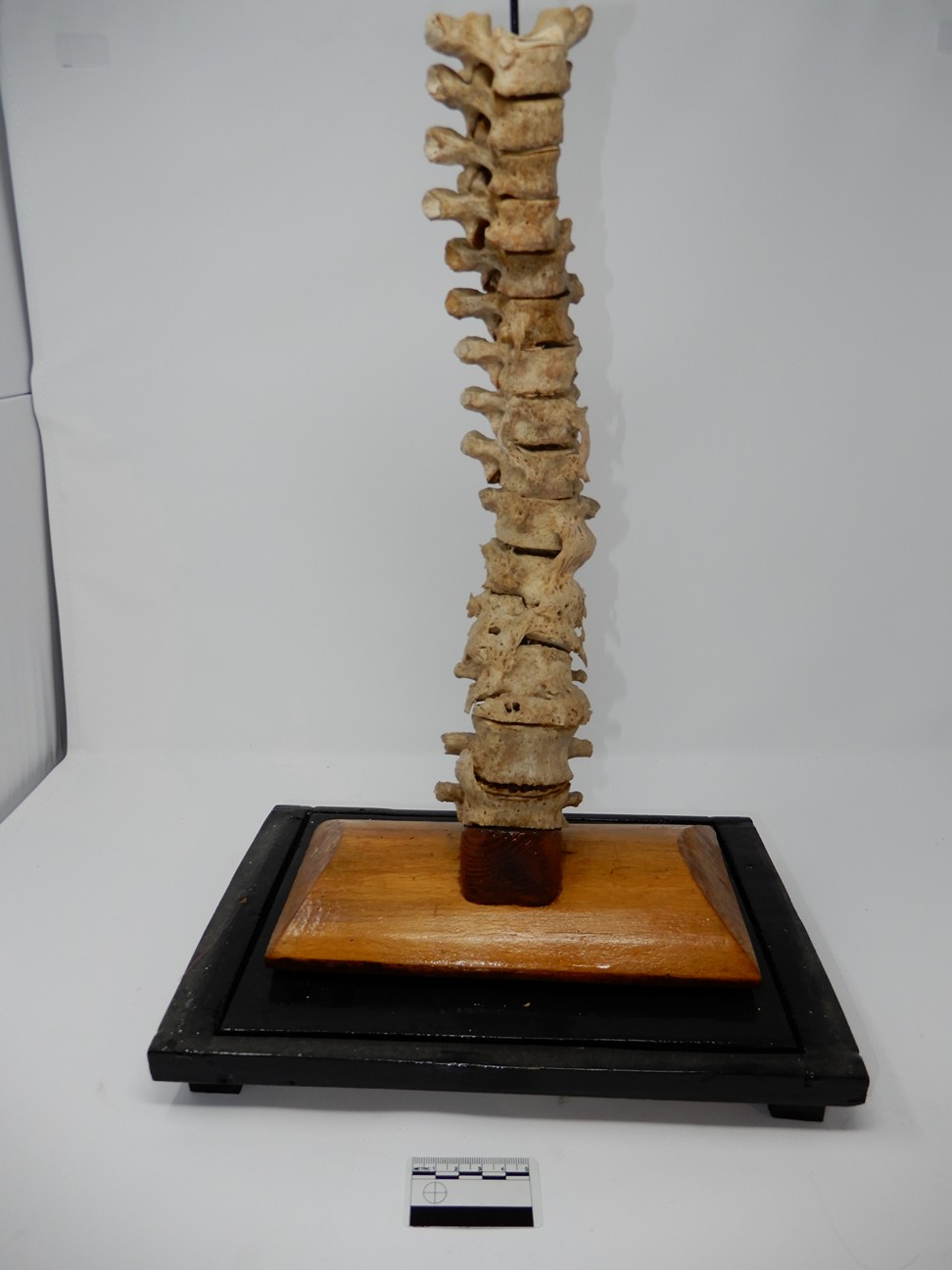 singolo reperto antropologico, reperto osseo (morfologia alterata per patologia) (XIX-XX)