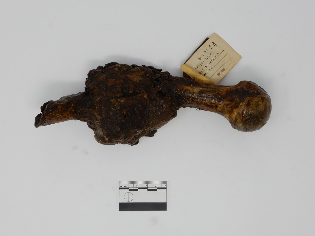 singolo reperto antropologico, reperto osseo (morfologia alterata per patologia) (XIX-XX)