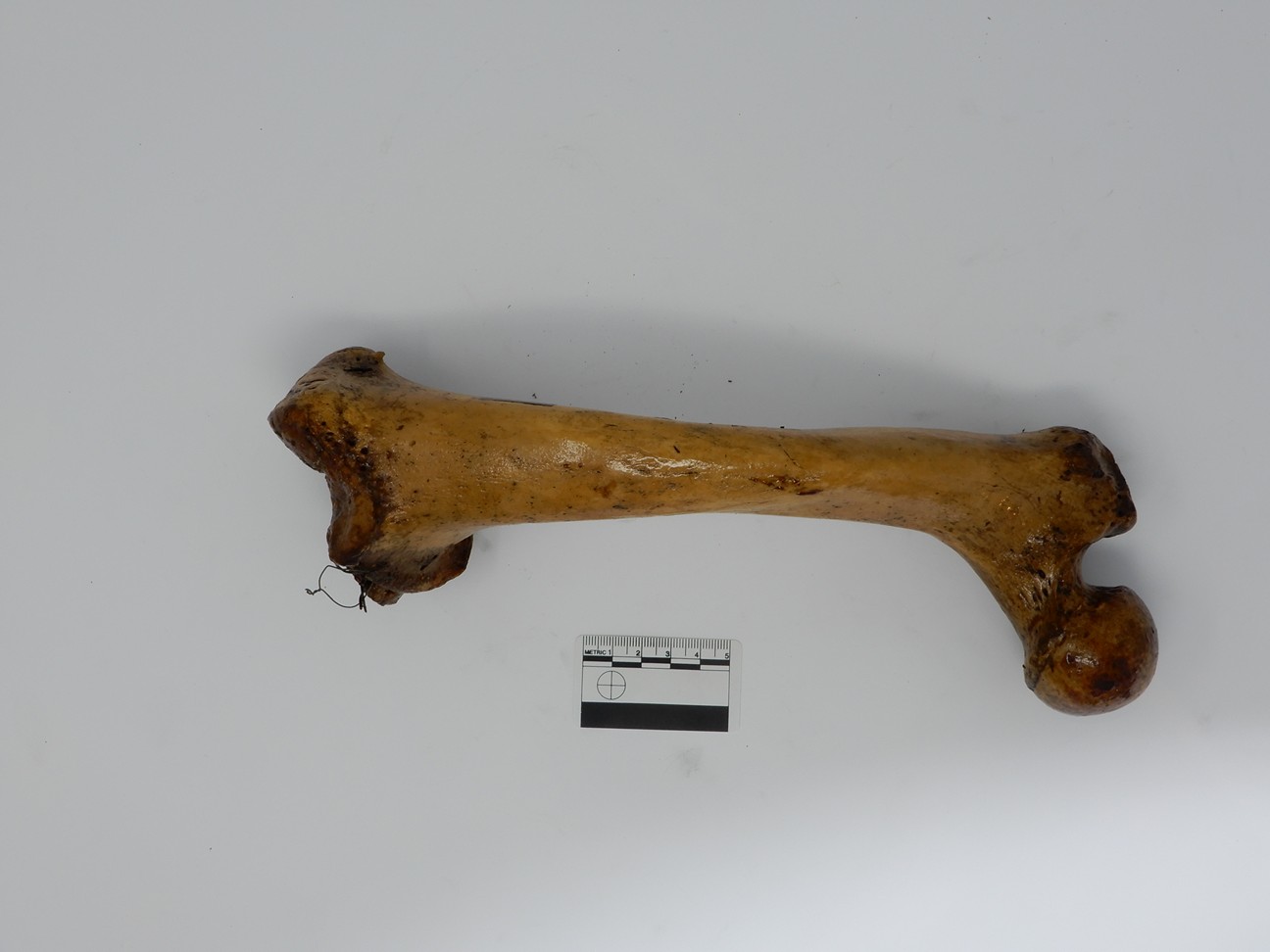 singolo reperto antropologico, reperto osseo (morfologia alterata per patologia) (XIX-XX)