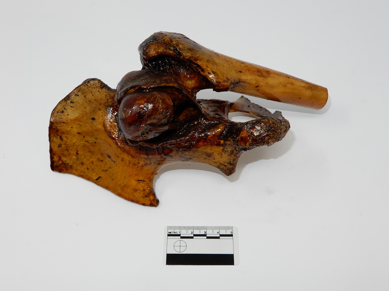 singolo reperto antropologico, reperto osseo (morfologia alterata per patologia) (XIX-XX)