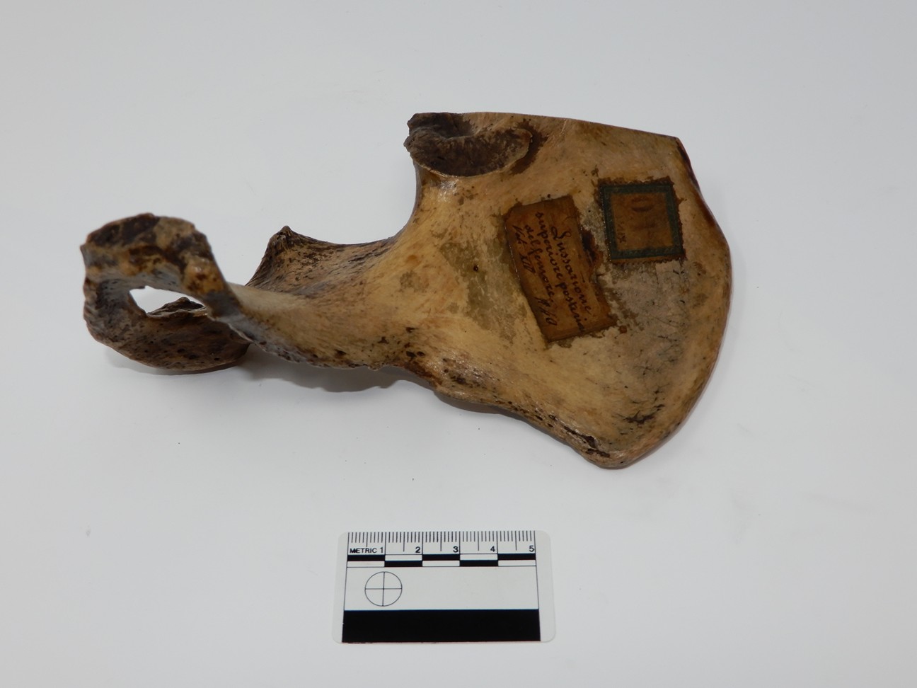 singolo reperto antropologico, reperto osseo (morfologia alterata per patologia) (XIX-XX)