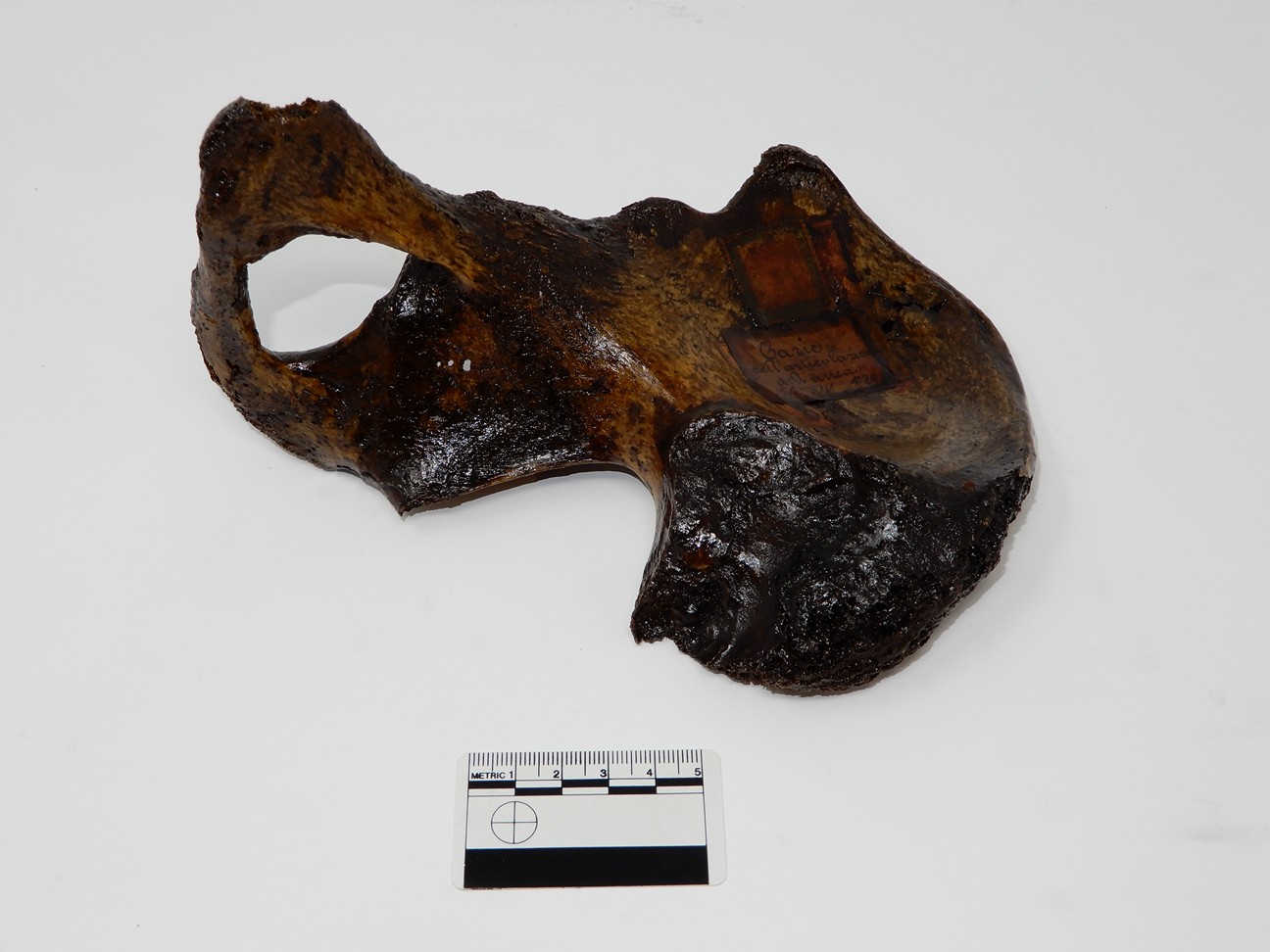 singolo reperto antropologico, reperto osseo (morfologia alterata per patologia) (XIX-XX)