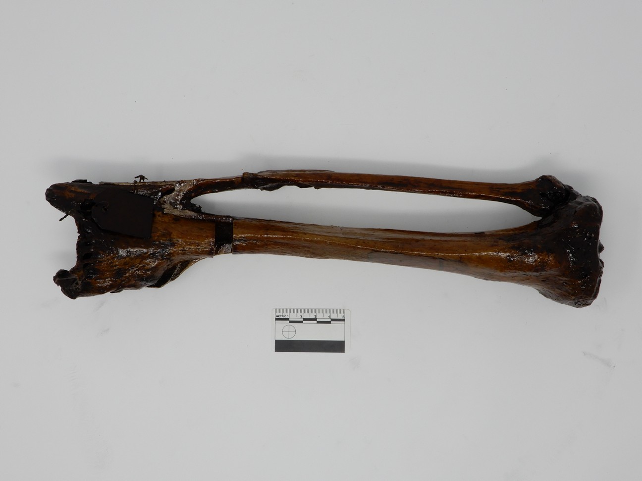 singolo reperto antropologico, reperto osseo (morfologia alterata per patologia) (XIX-XX)