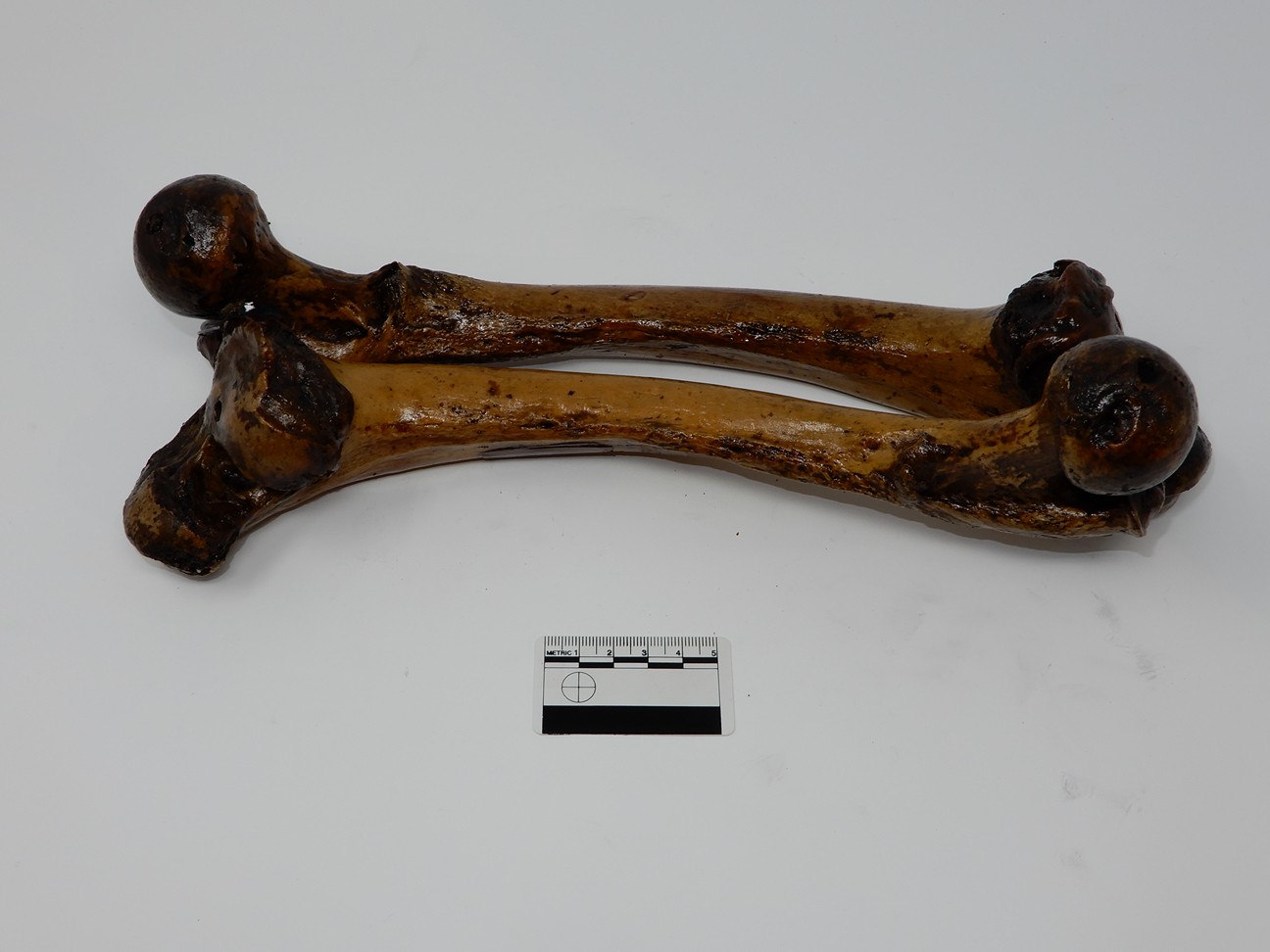 singolo reperto antropologico, reperto osseo (morfologia alterata per patologia) (XIX-XX)