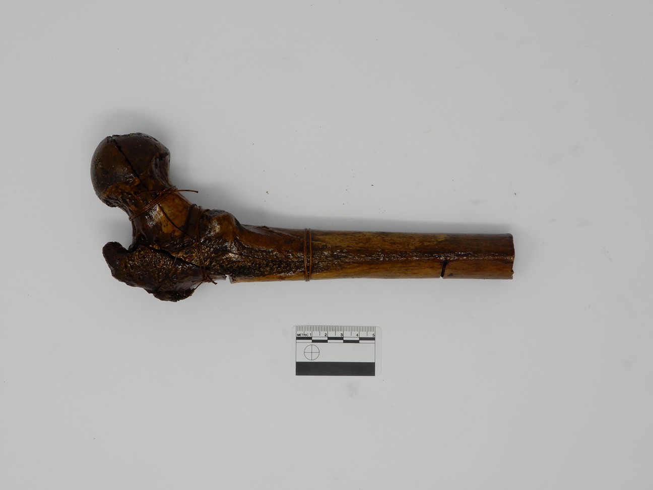 singolo reperto antropologico, reperto osseo (morfologia alterata per patologia) (XIX-XX)