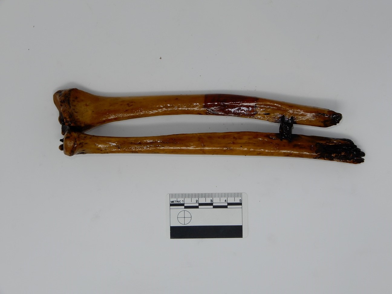 singolo reperto antropologico, reperto osseo (morfologia alterata per patologia) (XIX-XX)