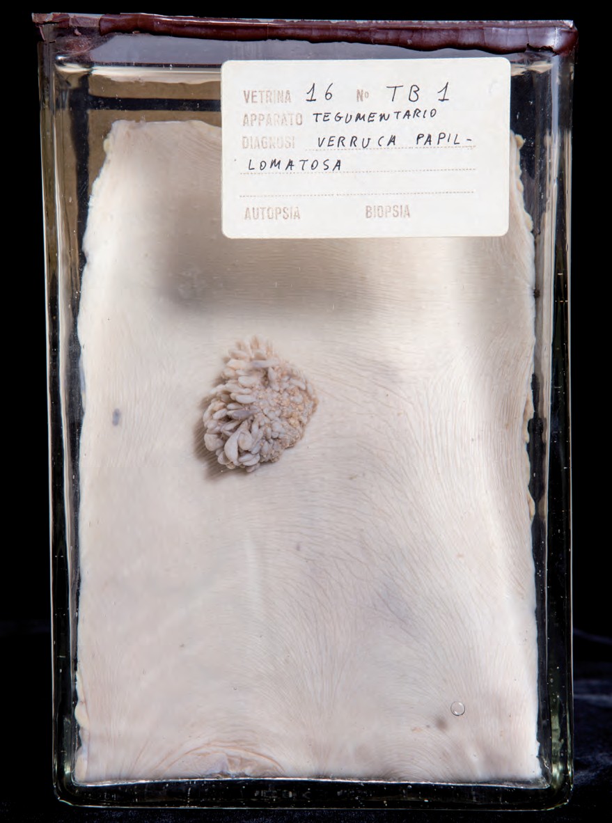 singolo reperto antropologico, preparato anatomico (morfologia alterata per patologia) (XIX-XX)