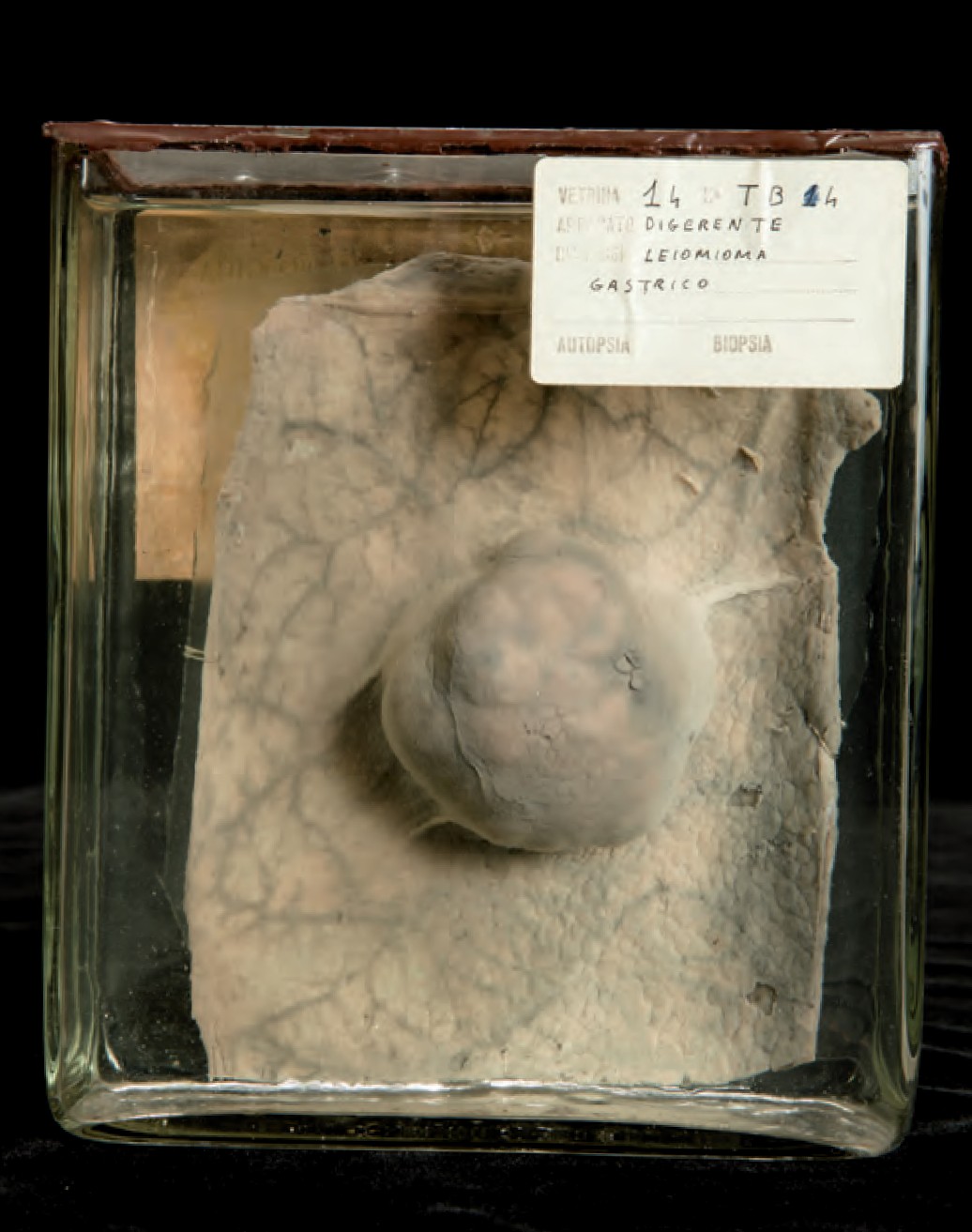 singolo reperto antropologico, preparato anatomico (morfologia alterata per patologia) (XIX-XX)