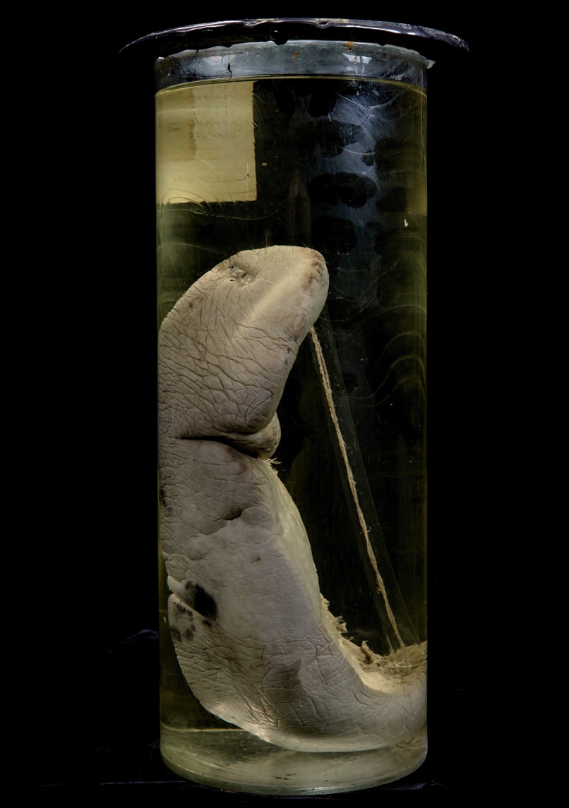 singolo reperto antropologico, preparato anatomico (morfologia alterata per patologia) (XIX-XX)