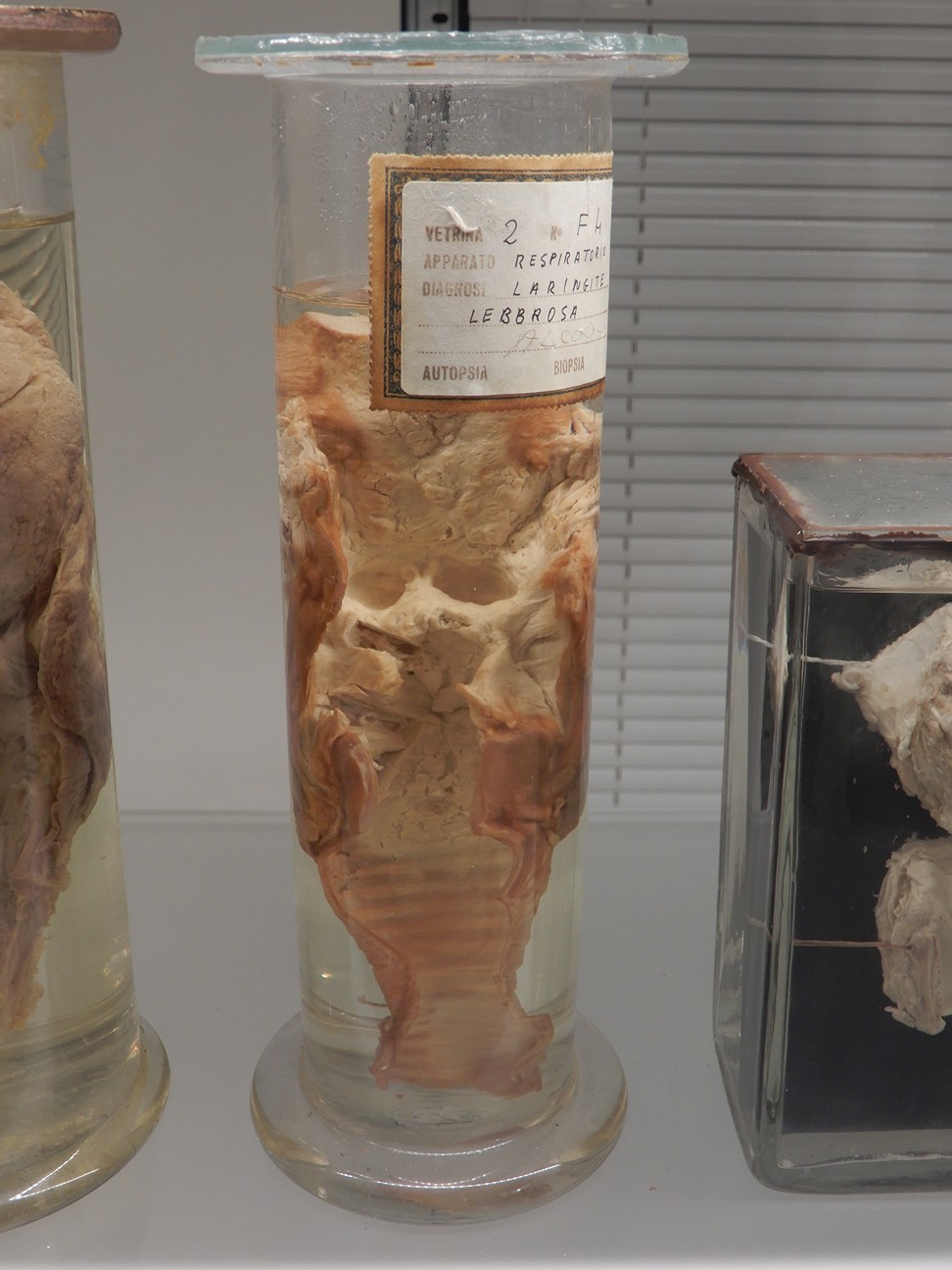 singolo reperto antropologico, preparato anatomico (morfologia alterata per patologia) (XIX-XX)