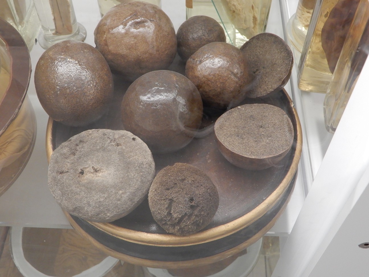 singolo reperto antropologico, preparato anatomico (morfologia alterata per patologia) (XIX-XX)